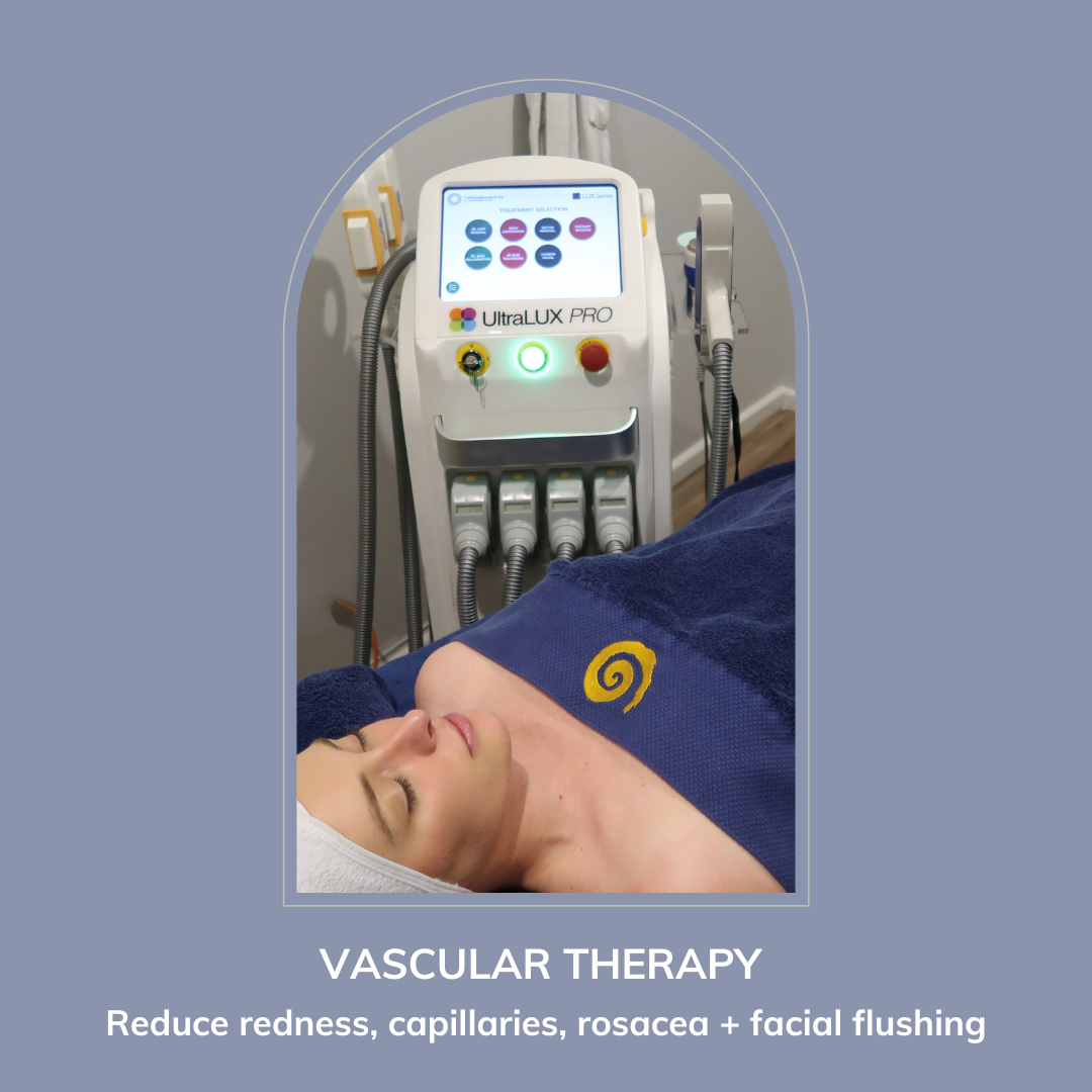 IPL Vascular Treatment