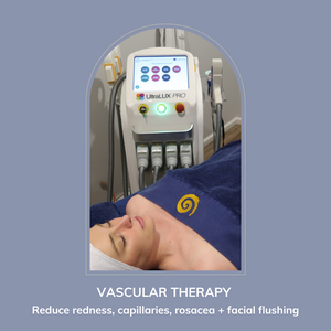 IPL Vascular Treatment